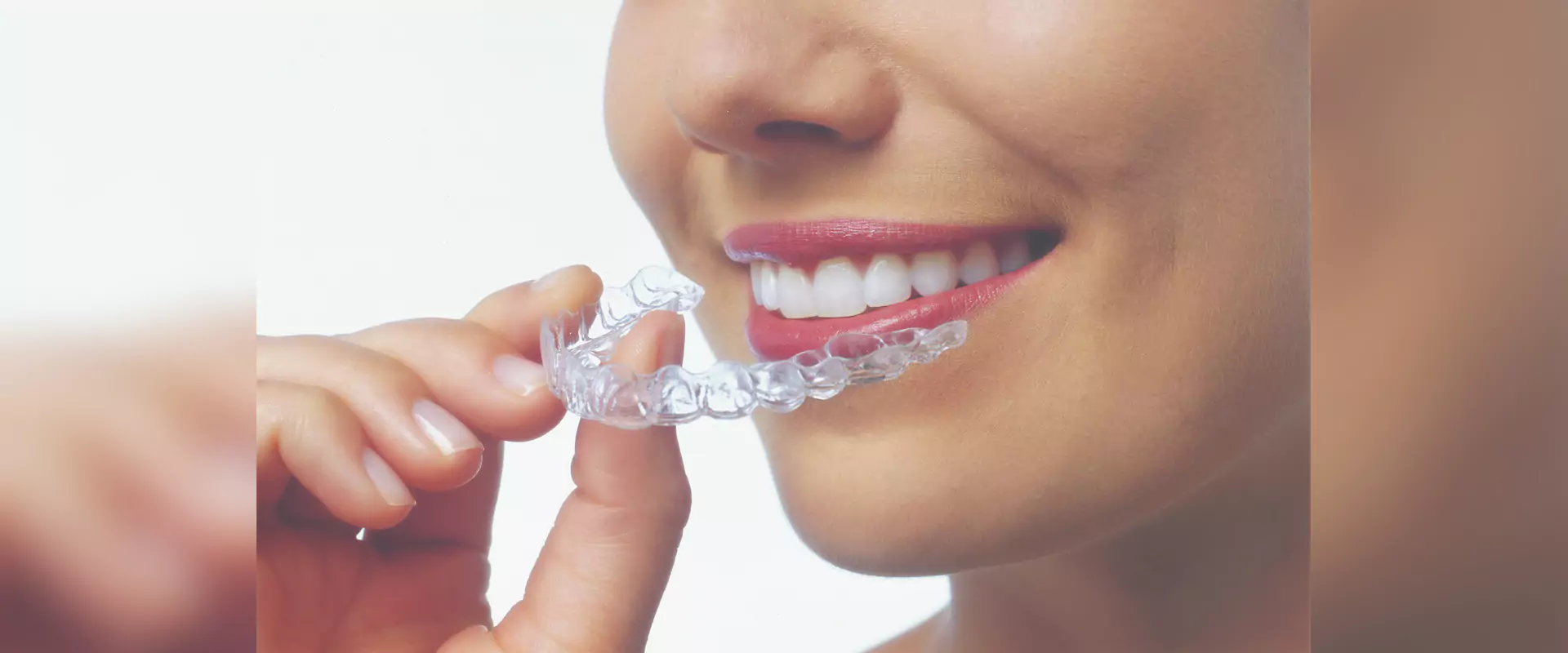 Craft your Dream smile with our Invisalign Clear Aligners